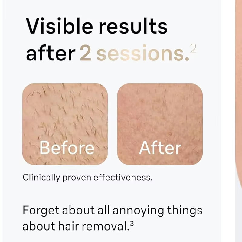Revolutionary Permanent IPL Laser Hair Removal Device for Effortless Hair Removal for Both Men and Women with Advanced Vibration Technology